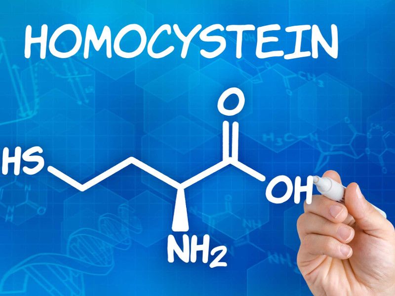 Omocisteina