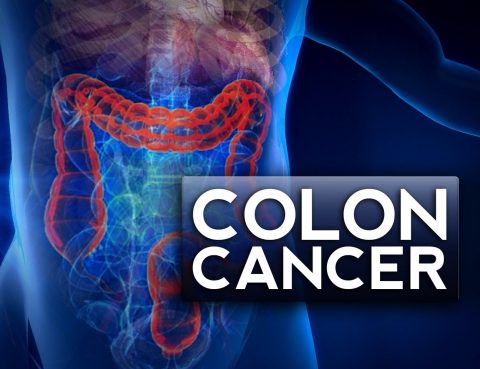 COLORECTAL CANCER ANALISI CATA CATANIA